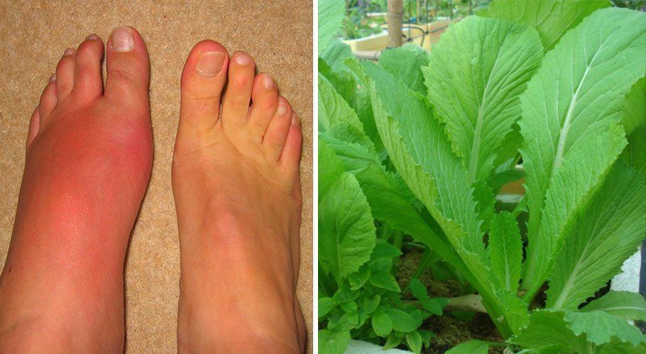 Điều trị bệnh gout 20 năm cũng khỏi nhờ ăn lẩu xông hơi